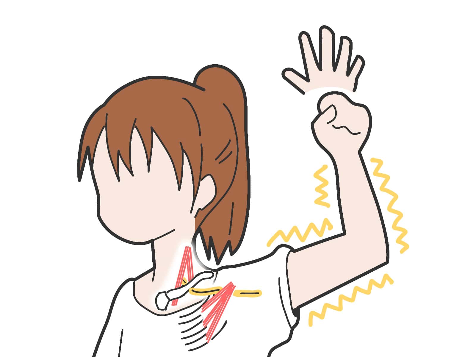 胸郭出口症候群で痛む場所を示しているイラスト画像