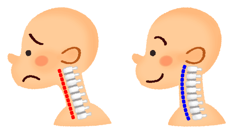 ストレートネックのイラスト画像